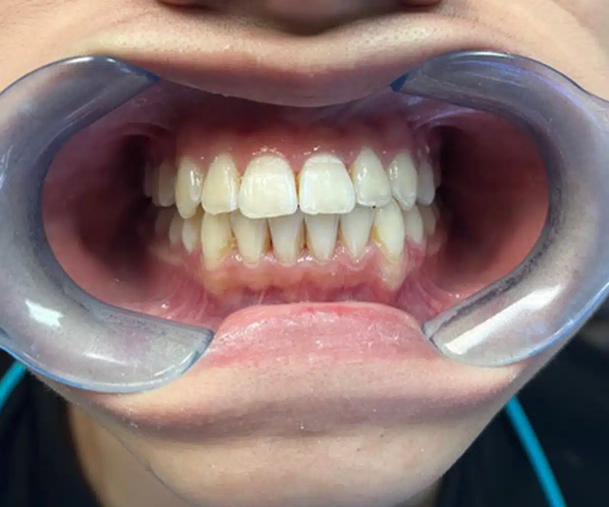 Ortho After