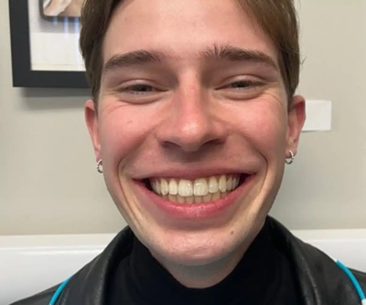 Ortho after