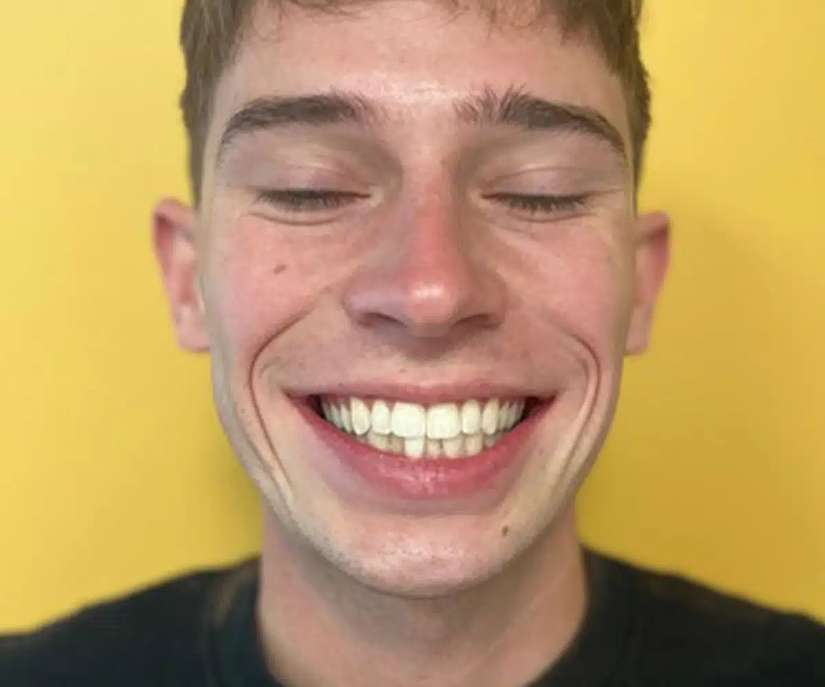 Ortho before