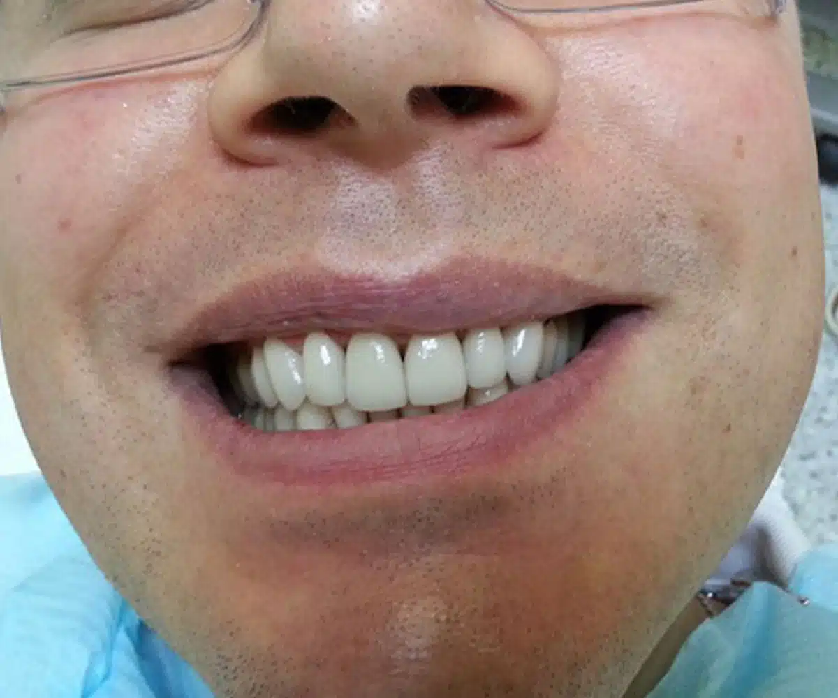 Men with white tooth