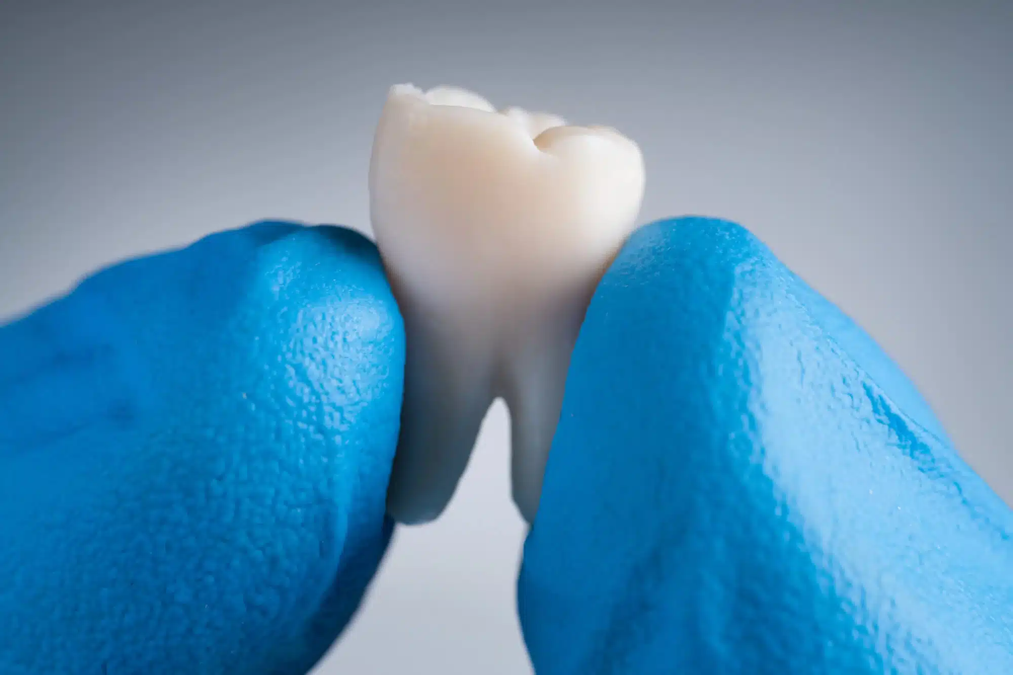 Novi Dentist holding an extracted tooth