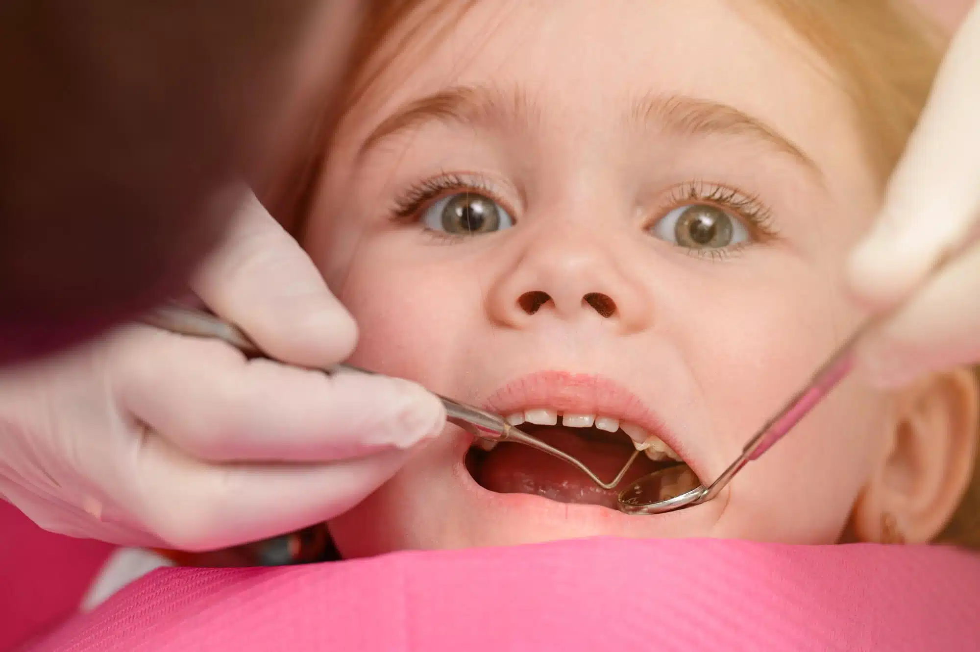 having teeth checked at My Family Dental in Novi