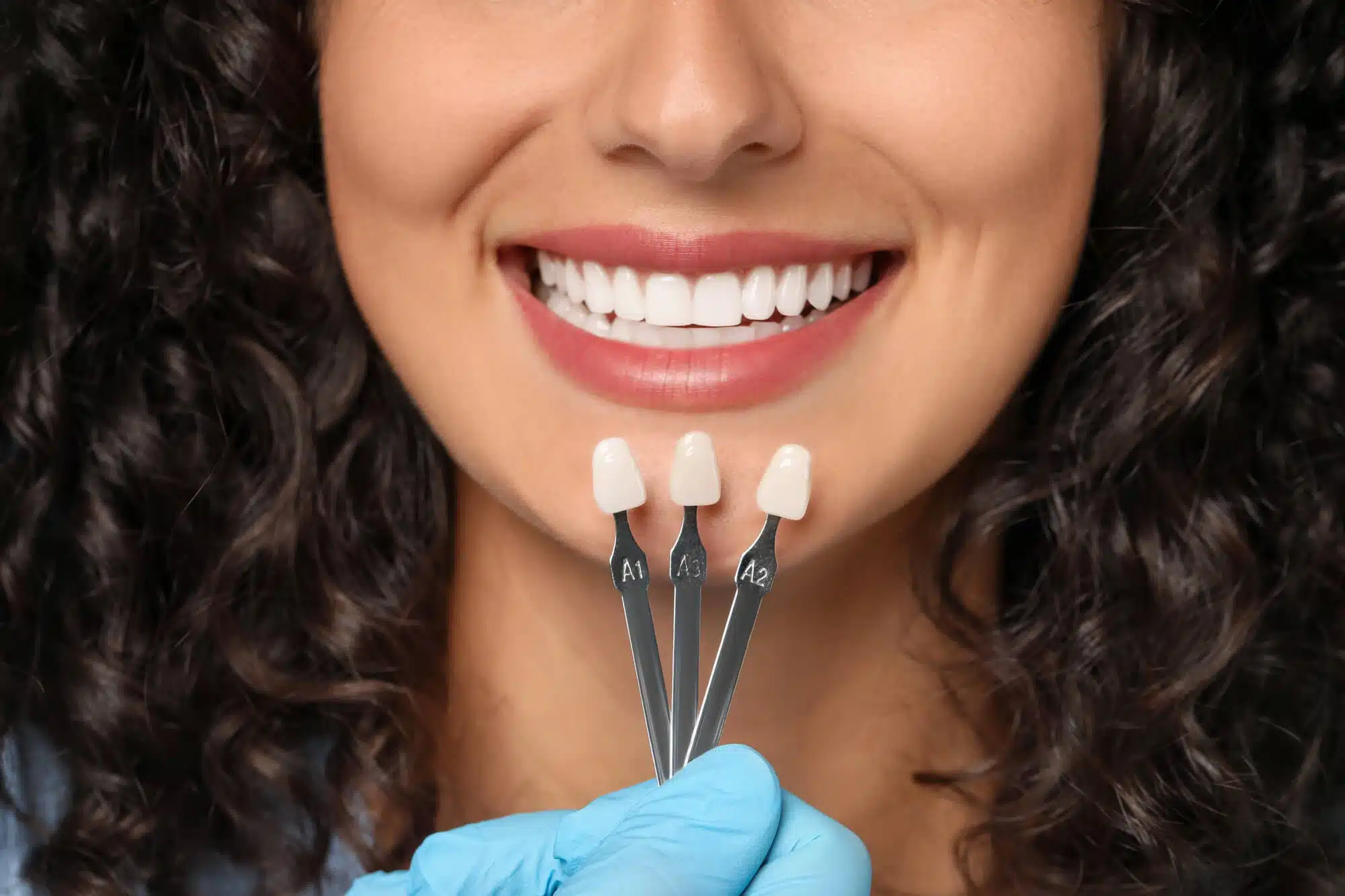 getting-Porcelain-Veneers-in-Novi-MI