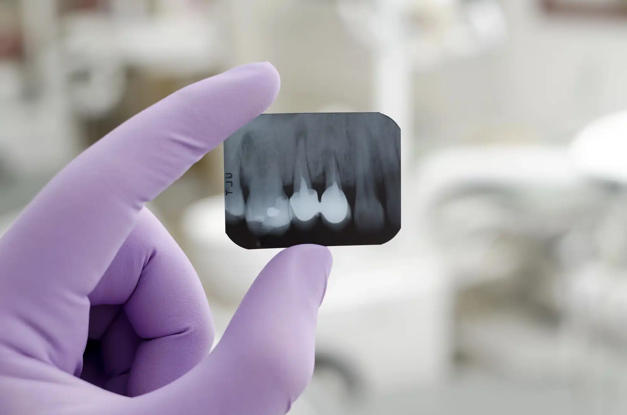 gloved-hand-holding-dental-xray-Novi-endodontics